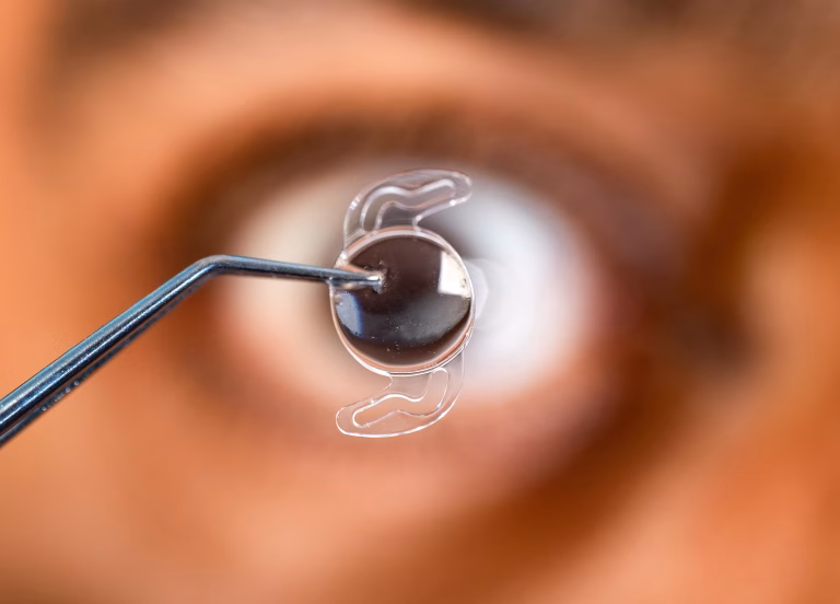Close-up of an intraocular lens (IOL) held with surgical forceps before cataract surgery.